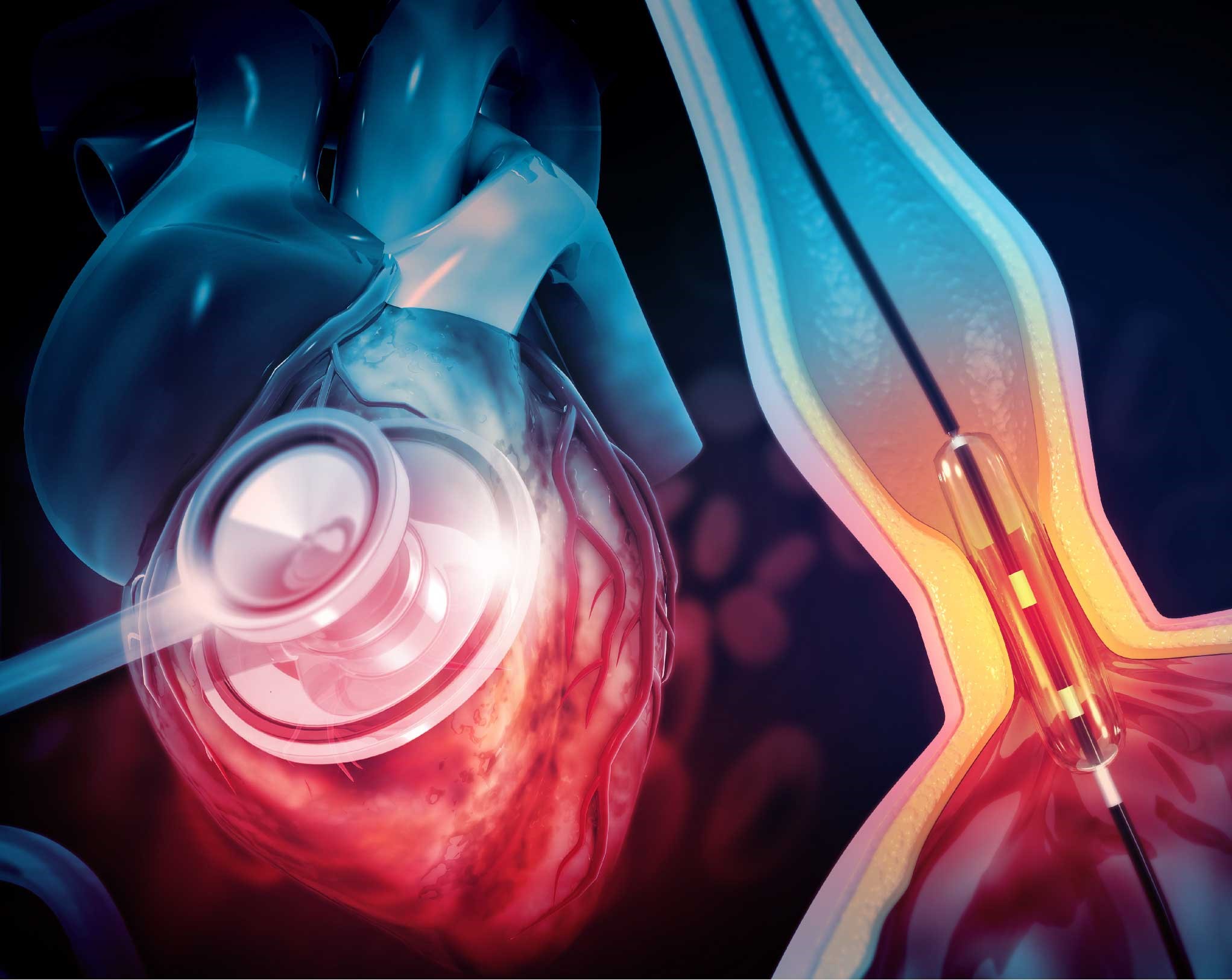 What is angiogram?